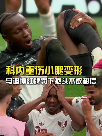 加拿大飞翼小腿恐怖变形！足球赛场惊魂一幕引全球球迷揪心